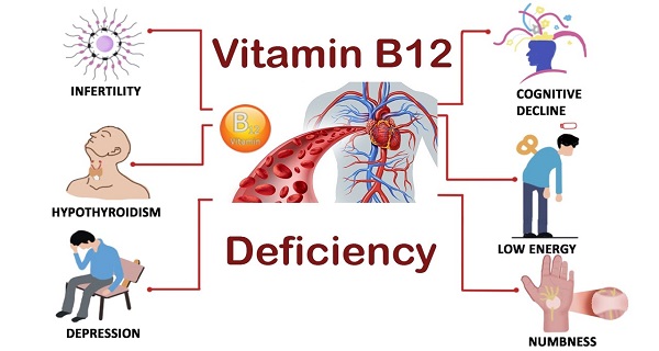 vitamin b12 