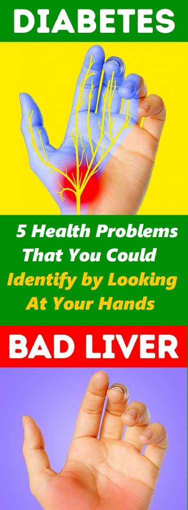 5 Health Problems That You Could Identify by Looking at Your Hands